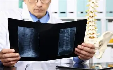 راهکاری که بعد از 40 سالگی استخوان‌ها را قوی می‌کند