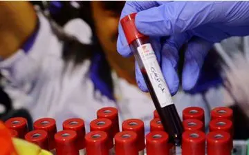 پاسخ تست PCR اعضای تیم فوتبال استقلال منفی بود