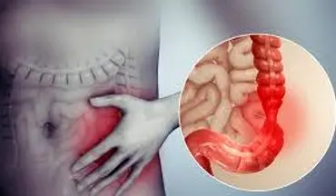  سندرم روده تحریک‌پذیر را جدی بگیرید!