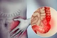  سندرم روده تحریک‌پذیر را جدی بگیرید!