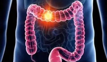 
از کنار این علائم گوارشی به سادگی عبور نکنید