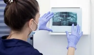 باورهای نادرست در مورد مراقبت از دندان ها که دیگر منسوخ شده اند