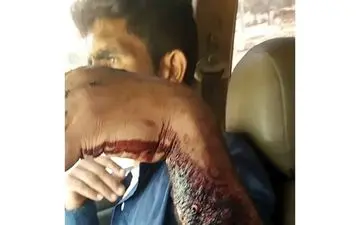 خرس وحشی دست مرد خوزستانی را درید