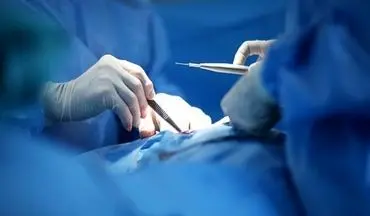 عمل جراحی استفاده از غضروف دنده به جای گوش برای دختر 19ساله در این شهر جنوبی کشور