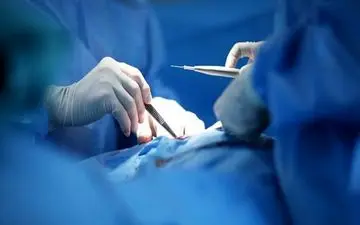 عمل جراحی استفاده از غضروف دنده به جای گوش برای دختر 19ساله در این شهر جنوبی کشور