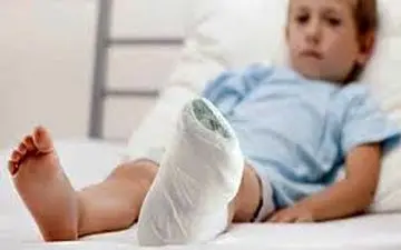 5 نشانه پوکی استخوان در کودکان را بشناسید