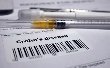 بیماری کرون چیست و چه علائمی دارد؟