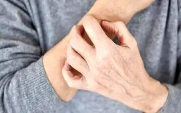 برای مراقبت از پوست در سرما چه کنیم؟

