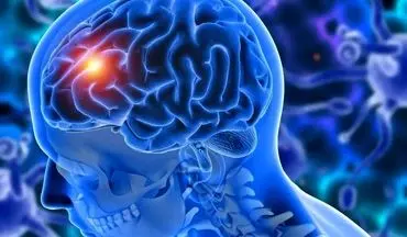گلیوبلاستوما چیست و چرا تا این حد نگران‌کننده محسوب می‌شود؟