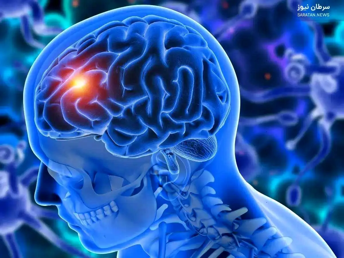 گلیوبلاستوما چیست و چرا تا این حد نگرانکننده محسوب میشود؟