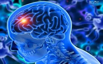 گلیوبلاستوما چیست و چرا تا این حد نگران‌کننده محسوب می‌شود؟