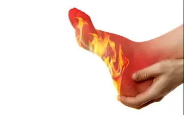 ۴ عامل موثر در بروز "گُر گرفتگی"