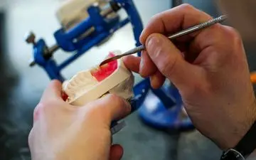 4 روش "سفت شدن لثه برای دندان مصنوعی" (1402)