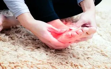 داغی کف دست و پا چه دلیلی دارد؟