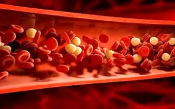 پنج علامت کلسترول بالا را بشناسید 