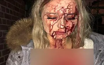 این دختر برای فرار از دام مرد شیطان صفت تا حد مرگ کتک خورد!!