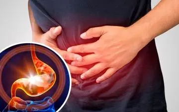 گاستریت چیست؟ علت‌ها، درمان و نحوه جلوگیری از التهاب معده