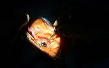 عمل موفقیت آمیز؛ نابینای مطلق بعد از 12 سال درمان شد/ دیدن چهره دخترم آرزویم است + فیلم