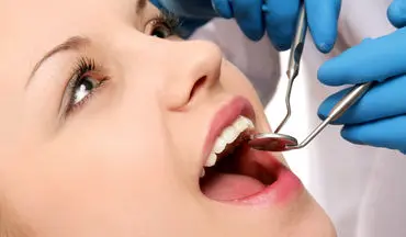 بهترین زمان برای جراحی دندان عقل 