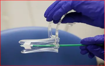 چه زمانی تست پاپ اسمیر انجام دهیم؟+ اینفوگرافی