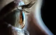سکته چشمی: علائم هشداردهنده و اقدامات ضروری