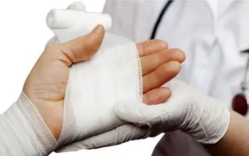  سریع سوختگی را با این موادی باورنکردنی درمان کنید