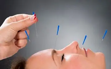 عوارض طب سوزنی