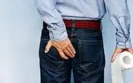 همه‌چیز درباره بواسیر؛ از علائم تا راه‌های پیشگیری