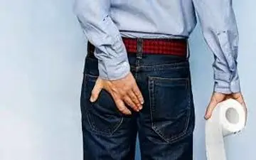 همه‌چیز درباره بواسیر؛ از علائم تا راه‌های پیشگیری