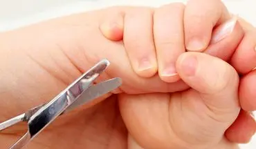ناخن های کودک خود را اینگونه کوتاه کنید