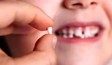 دندان‌هایی مهم اما فراموش شده در کودکان