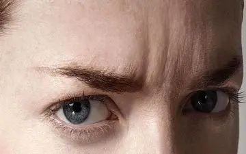 روش‌های طبیعی و موثر برای رفع خط اخم
