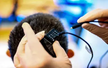 پدیده ای دیگر از هوش مصنوعی در حوزه پزشکی|اضافه شدن هوش مصنوعی به ایمپلنت مغزی سرعت تکلم در بیماران فلج را افزایش می‌دهد
