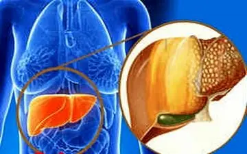  چطور کبد سالم داشته باشیم؟