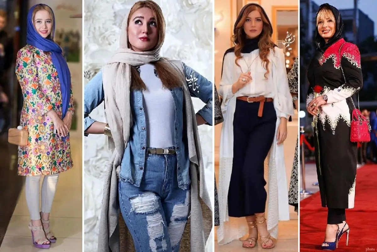 بازیگران زن ایرانی که با عمل زیبایی زشت تر شدند! + تصاویر