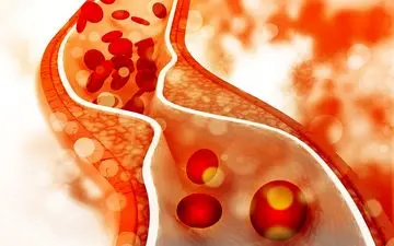 علائمی که می‌گوید کلسترول شما در جوانی به مرز هشدار رسیده است