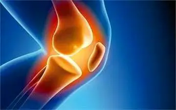 باورهای نادرست و غلط درباره آرتروز