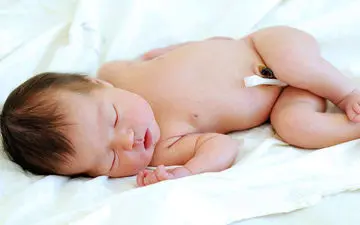 نکاتی درمورد بند ناف نوزاد