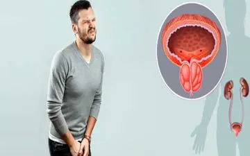 درمان خانگی پروستات