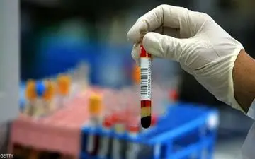 ۶ آزمایش خون حیاتی که از سلامت بدن شما خبر می‌دهد
