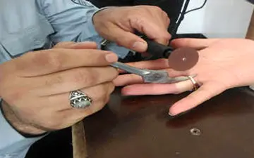 رهایی از انگشتر دردسر ساز