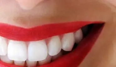 ترفند خانگی و ارزان برای رفع زردی دندان