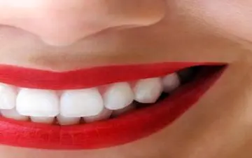 ترفند خانگی و ارزان برای رفع زردی دندان