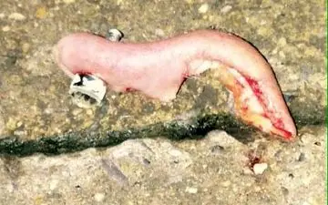 دختری با دندان گوش مادرش را کند+عکس گوش