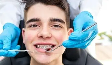 لق شدن روکش دندان هشداری برای مراجعه به دندانپزشک است