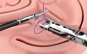 
دستگاهی برای بخیه زدن زخم‌های عمیق + فیلم