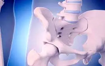 10گام از پوکی استخوان فاصله بگیرید