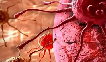 چگونه با رژیم غذایی خطر ابتلا به سرطان سینه را کاهش دهیم؟