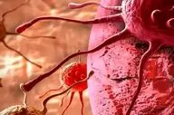 چگونه با رژیم غذایی خطر ابتلا به سرطان سینه را کاهش دهیم؟