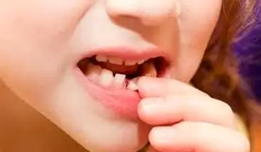 به این دلایل مراقب دندان‌های شیری فرزندانتان باشید!